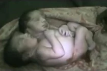 Kỳ lạ bé trai bẩm sinh đã có 2 đầu 