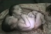 Kỳ lạ bé trai bẩm sinh đã có 2 đầu 