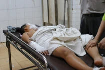 Đắk Lắk: Nổ bình ga mini, 5 học sinh tiểu học bị bỏng