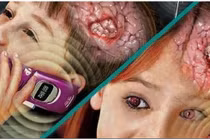 Cách dùng điện thoại thông minh ngừa ung thư não