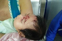 Bé 2 tháng tuổi suýt bị khỉ bắt cóc ở Quảng Bình