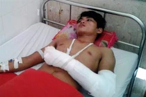 Ngăn khách xem phim đen, chủ quán bị chém