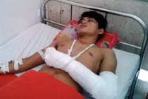 Ngăn khách xem phim đen, chủ quán bị chém