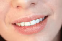 Bệnh tật đằng sau triệu chứng nứt nẻ môi