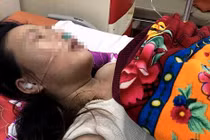 Chồng đánh vợ tổn thương sọ não, nhập viện cấp cứu