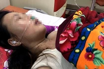 Chồng đánh vợ tổn thương sọ não, nhập viện cấp cứu