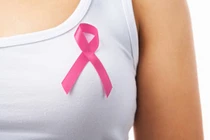 Sự thật khác xa tưởng tượng về ung thư vú