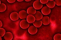 Nhóm máu nào dễ mắc bệnh tim nhất?