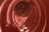 Dấu hiệu bệnh ung thư cướp đi sinh mạng của nhạc sĩ Trần Lập