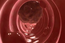 Dấu hiệu bệnh ung thư cướp đi sinh mạng của nhạc sĩ Trần Lập