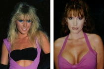 Nữ diễn viên Hollywood bị virus ăn mất ngực