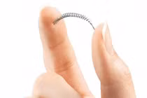 Kinh hãi hàng loạt phụ nữ thủng tử cung vì lò xo tránh thai