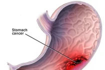 Giảm cân bằng rượu, phúc ít họa nhiều