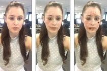 Hãi hùng khuôn mặt bị phá hủy do nghiện ma túy