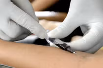 Rúng động những y tá bệnh hoạn hành hạ bệnh nhân