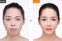 Những cô gái Việt đổi đời nhờ phẫu thuật thẩm mỹ