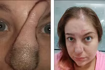 Hết hồn ngắm người phụ nữ có mũi dài như vòi voi