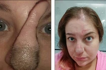 Hết hồn ngắm người phụ nữ có mũi dài như vòi voi