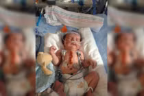 Xót lòng những em bé dị tật tim bẩm sinh