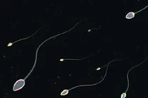 Nguyên nhân khiến quý ông bị xuất tinh ngược