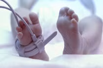 Sau đẻ 4 tháng mới biết con mình không có hậu môn 