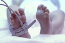 Sau đẻ 4 tháng mới biết con mình không có hậu môn 