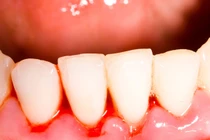 7 dấu hiệu báo động bạn đang stress vì thiếu chất