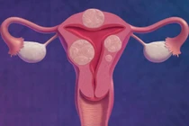 Ra máu đen khi quan hệ cảnh báo nguy hiểm gì?