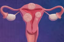 Ra máu đen khi quan hệ cảnh báo nguy hiểm gì?