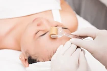 Tường tận về liệu pháp làm đẹp bằng tế bào gốc 
