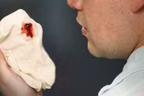 Ho ra máu có thể là dấu hiệu của bệnh chết người nào?