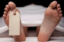 Những cô gái thân tàn ma dại vì tắm trắng bằng kem trộn