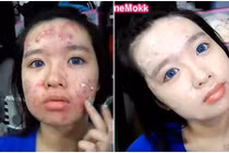 Clip trang điểm che mụn rùng rợn khiến bác sĩ hết hồn