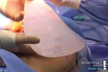 Trai đẹp độn 2 tảng silicone to tướng vào lưng