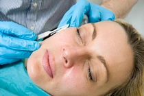 Cách xóa nếp nhăn rùng rợn: dùng dao lam cạo mặt