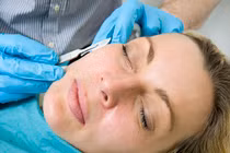 Cách xóa nếp nhăn rùng rợn: dùng dao lam cạo mặt