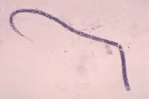 10 loại ký sinh trùng trong mắt có thể gây mù