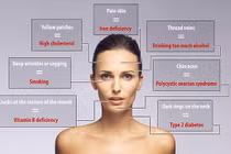 7 dấu hiệu bệnh nan y dễ nhận thấy trên mặt bạn