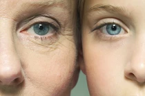 Già nhanh hơn vì lạm dụng sản phẩm chống lão hóa 