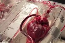 Xanh mặt xem trái tim người đập trong hộp nhựa