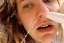 Mẹo giảm khó chịu do viêm xoang thời tiết giao mùa