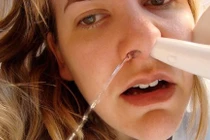 Mẹo giảm khó chịu do viêm xoang thời tiết giao mùa