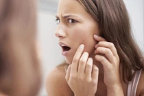 9 nguyên nhân khiến mụn mọc chi chít nhưng ít ai để ý