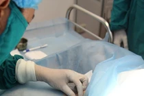 Những sự thật cần biết khi muốn tiêm botox trị hôi nách