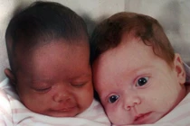 Kỳ lạ những ca sinh đôi nhưng mỗi con một bố 