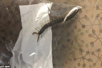 "Chết ngất" khi tự kéo con rết dài 10 cm ra khỏi tai 