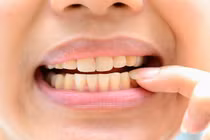 7 sự thật về tẩy trắng răng