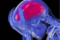 Top nguy hiểm chết người khi uống thuốc tránh thai quá liều 