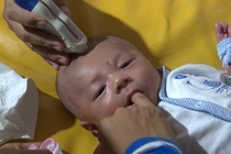 Ổ vi trùng nằm trong não bé bị dao đâm xuyên sọ