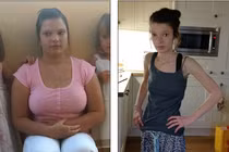 Gái xinh thành xác sống vì uống 90 viên thuốc giảm cân